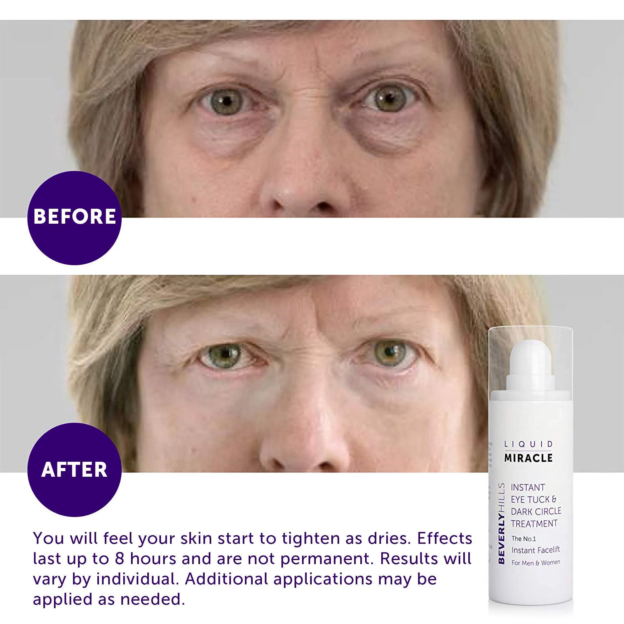 Beverly Hills Instant Facelift and Eye Serum Treatment for Dark Circles, Puffy Eyes, and Wrinkles