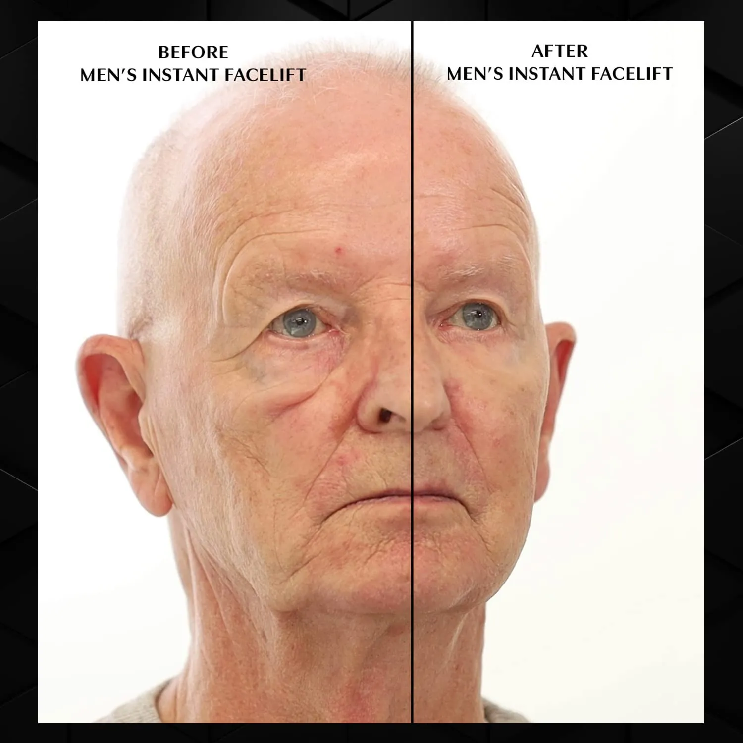 Beverly Hills Mens or Womens Instant Facelift and Eye Tuck Serum for Dark Circles and Puffy Eyes